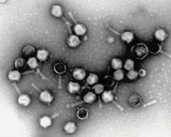 Image: Electron micrograph of particles of a virus (Photo courtesy of the University of Leeds).